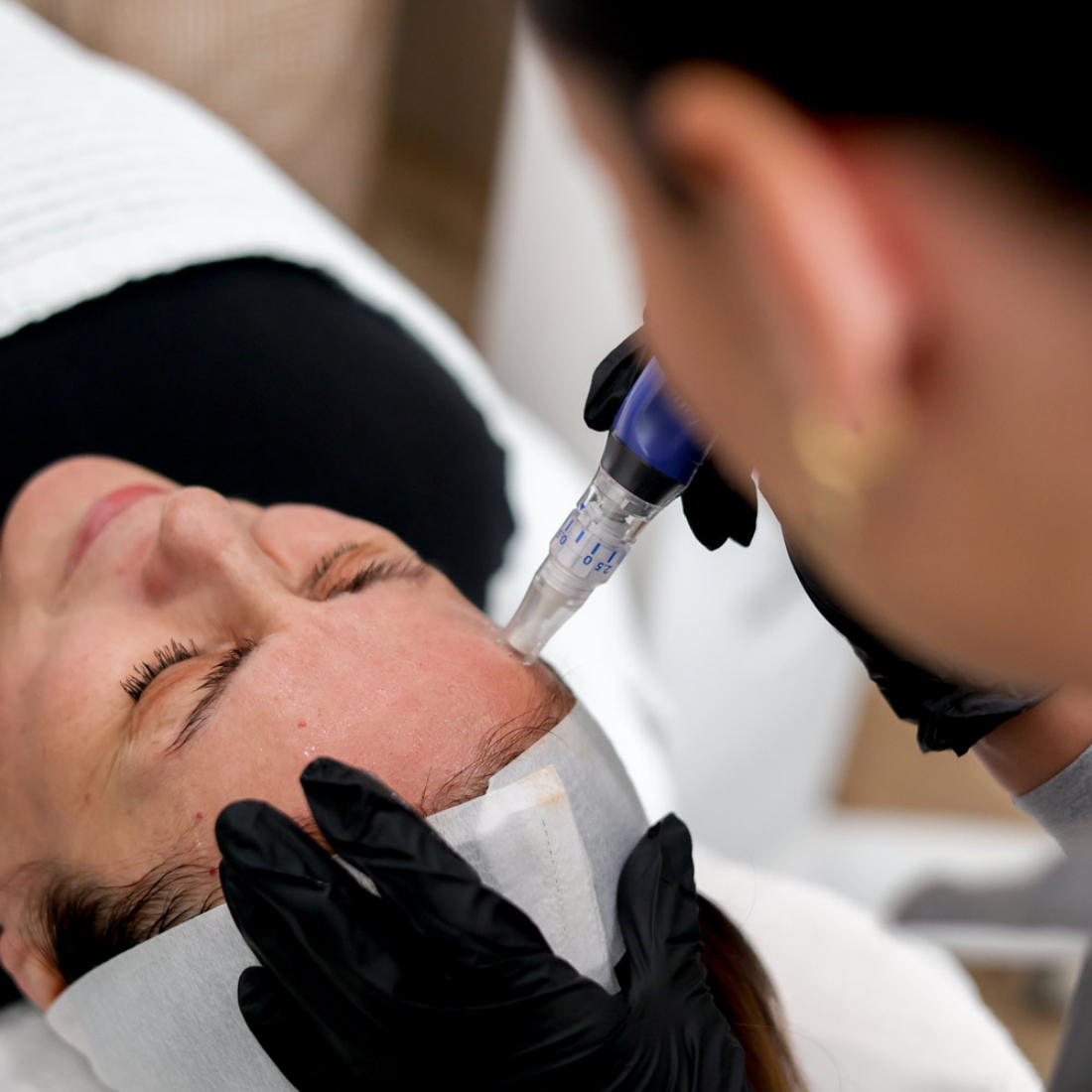 BUNDLE Renew &amp; Glow Package | Summer Deal